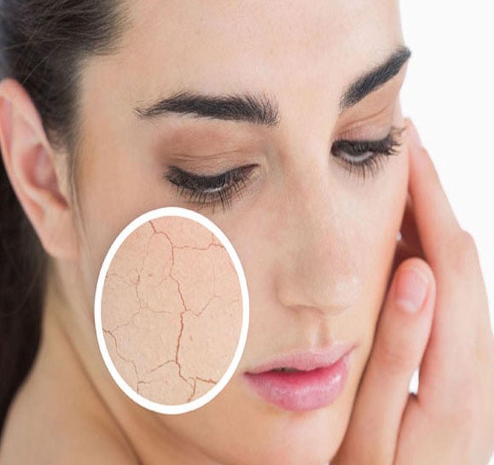 آبرسانی پوست