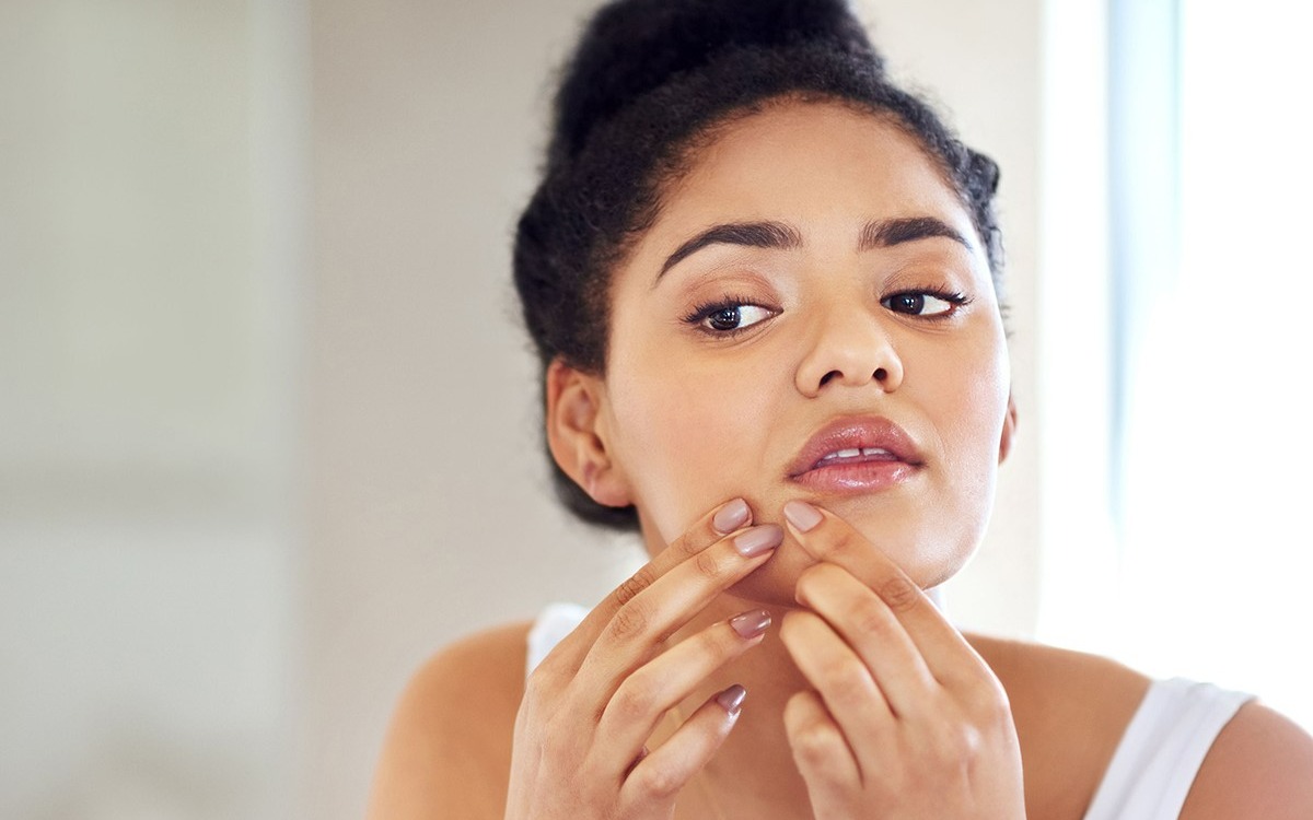 ترکوندن جوش - از بین بردن لک صورت