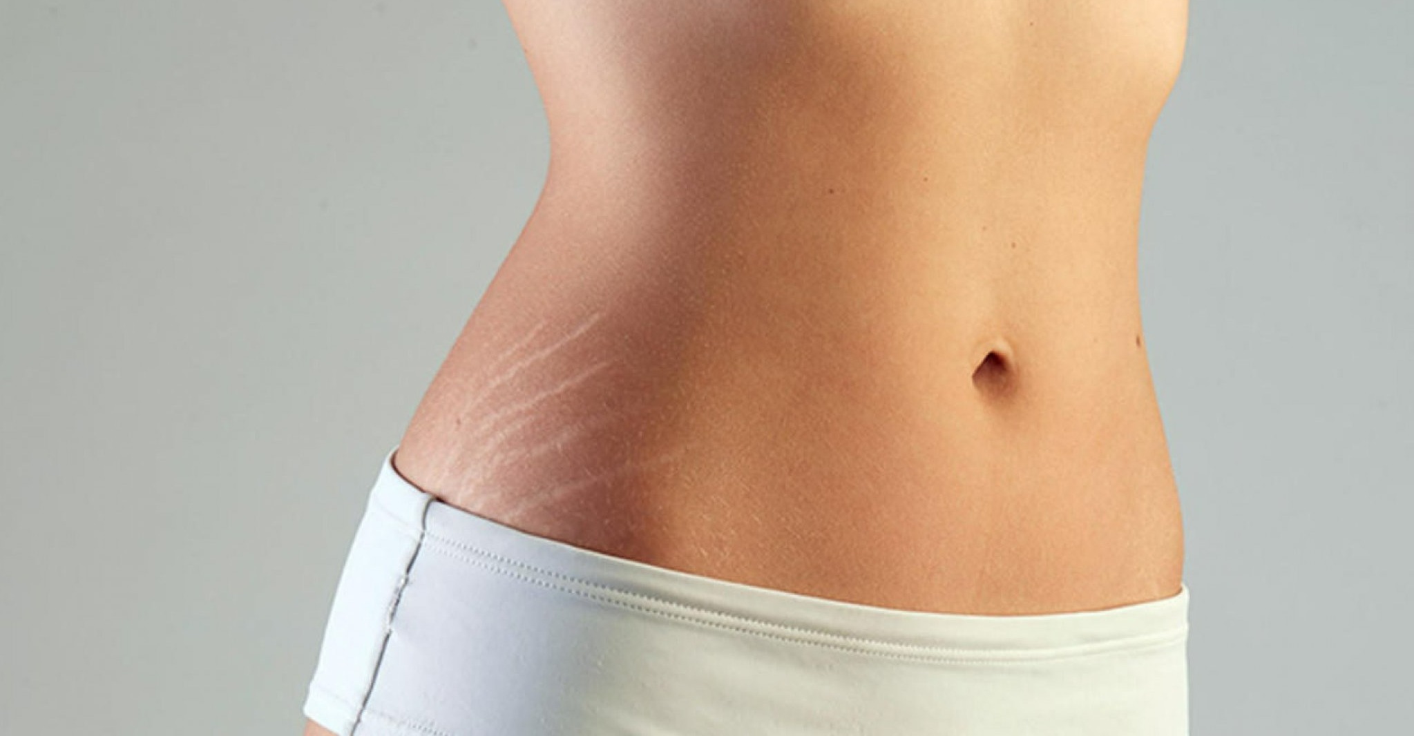 ترک شکم پهلو - درمان ترک پوستی