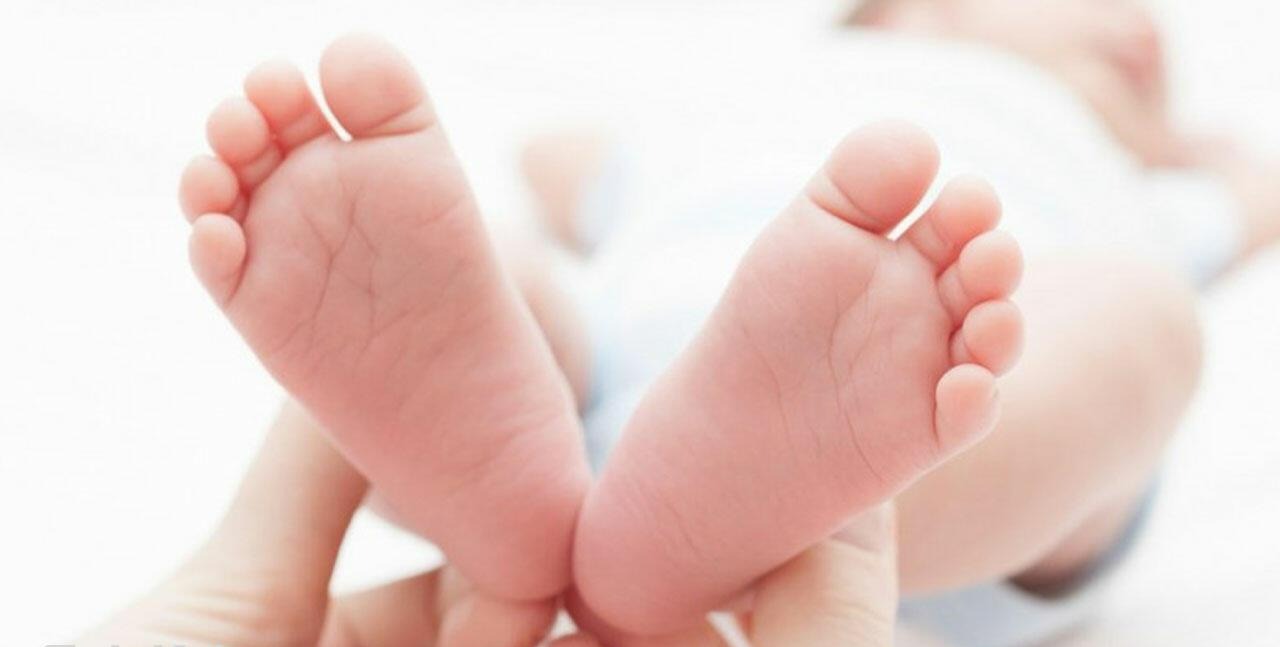 پای نوزاد - سوختگی پای نوزاد