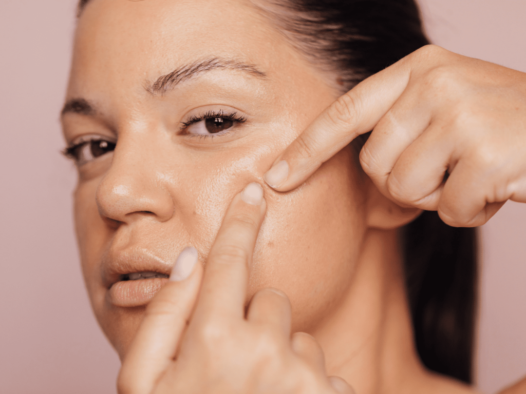 نحوه صحیح استفاده از کرم ضد لک؛ راهنمای کامل برای نتیجه سریعتر | فروشگاه اینترنتی آراویرا چرا استفاده از کرم ضد لک اهمیت دارد؟