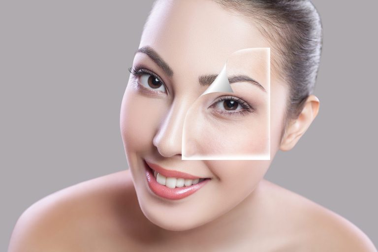 پیشگیری از تیرگی دور چشم