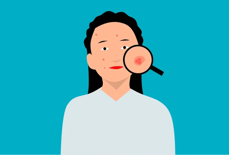 راکوتان چیست