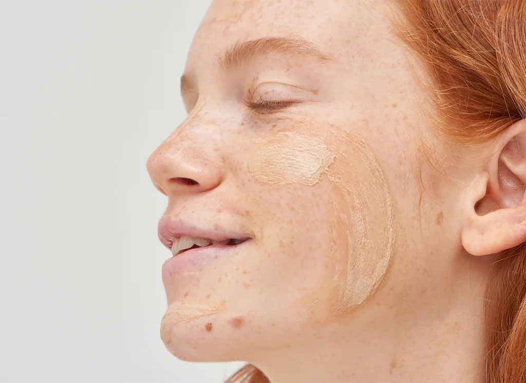 نشانه‌های پوست کدر در آلودگی هوا