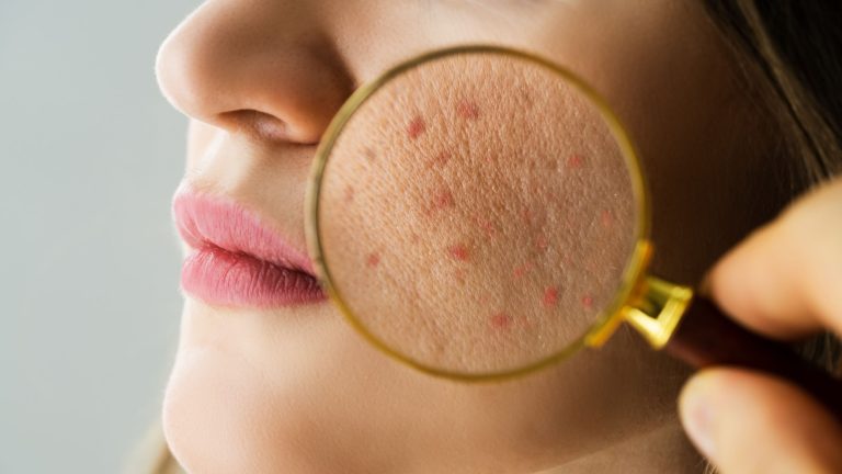 میکروبیوم پوست