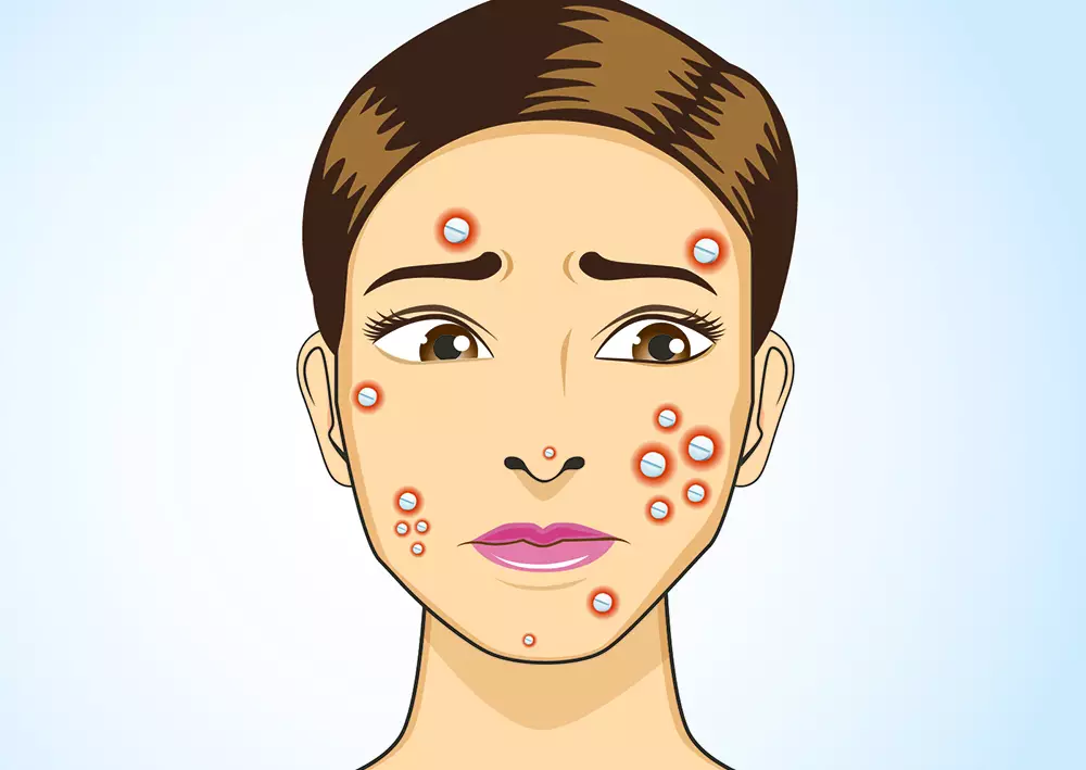 همه چیز درباره پماد تتراسایکلین؛ موارد مصرف، هشدارها و نحوه استفاده صحیح | فروشگاه اینترنتی آراویرا نحوه استفاده صحیح از پماد تتراسایکلین