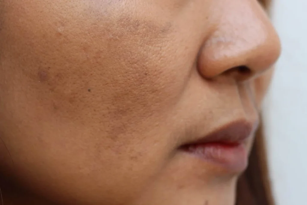 روتین پیشنهادی آراویرا برای پوست کدر و خسته